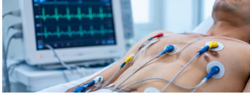 ECG machine recording a heart tracing